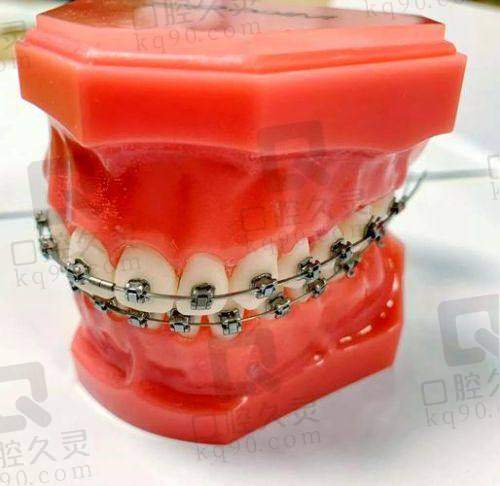 刘可乐正畸医生在哪家医院