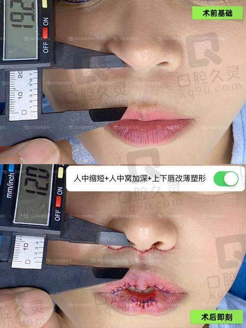 北京人中缩短选王晓健还是张曼好？技术、审美、价格全方位对比