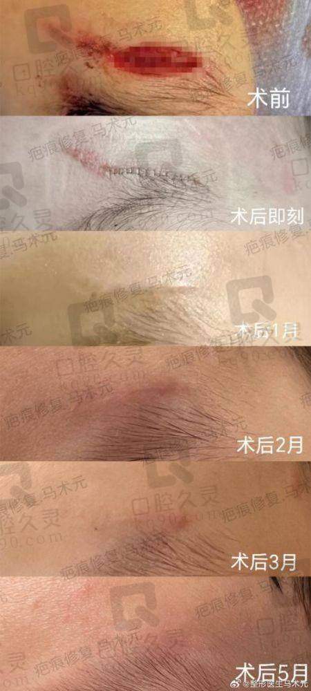 武晓莉医生挂号这么难，原因在哪里？