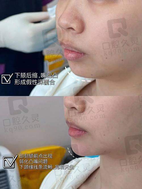 长沙雅美医疗美容医院怎么样？