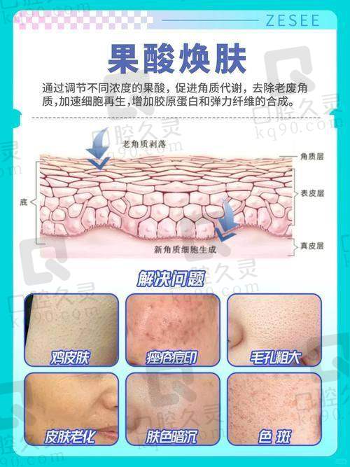 什么是果酸换肤？