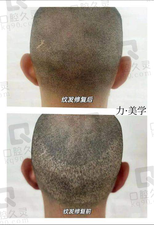 三、无锡百年植发诊所医生介绍: