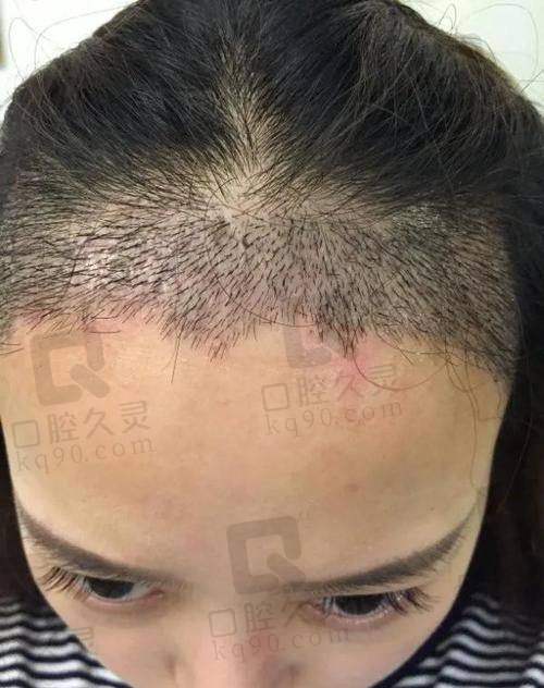 四、无锡百年植发诊所基本信息：