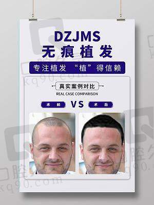 七、无锡大麦植发诊所价格表：（仅供参考）