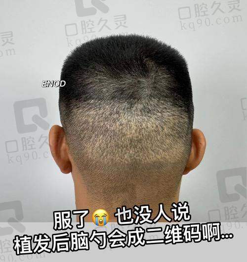 四、无锡大麦植发诊所基本信息：
