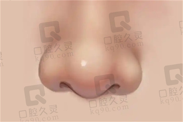 北京巫文云肋骨鼻子大概多少钱？受方案材料个人情况影响25000元到十几万不等