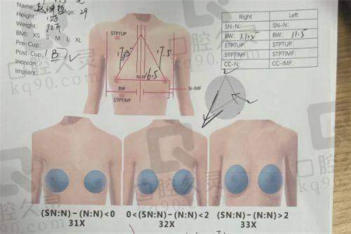 广州中家医家庭医生朱云Motiva梦萦假体隆胸127950元起——真实实例分享