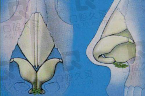 三、手术价格：中端档次，性价比高
