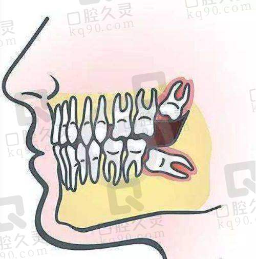 四、深圳穗华口腔其他口腔项目价格