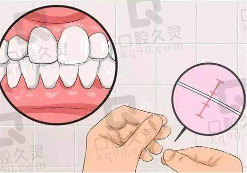 广安爱牙仕口腔医院牙齿矫正价格