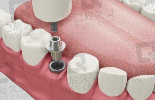 就诊前的检查是怎样的？