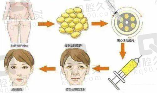 广州中家医家庭医生赵慧慧英伦大提升4710元起，价格透明且具竞争力