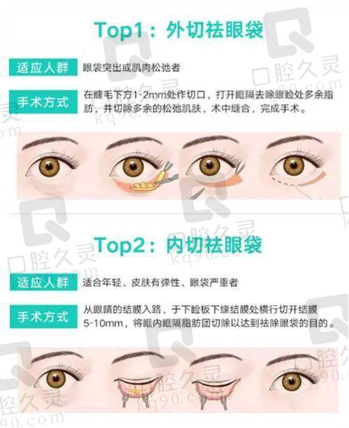 杭州双眼皮医生孟晨曦怎么样?专业背景、技术效果揭秘,与他人对比优势尽显