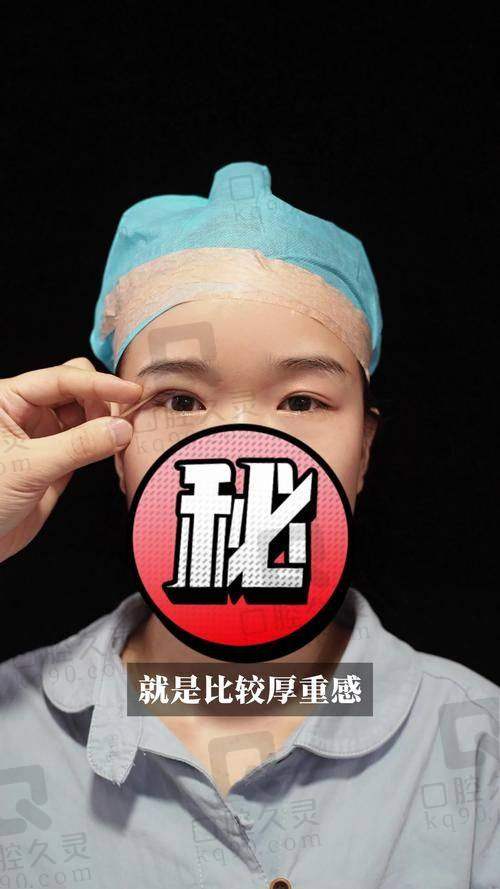 二、王保志医生双眼皮手术技术特点