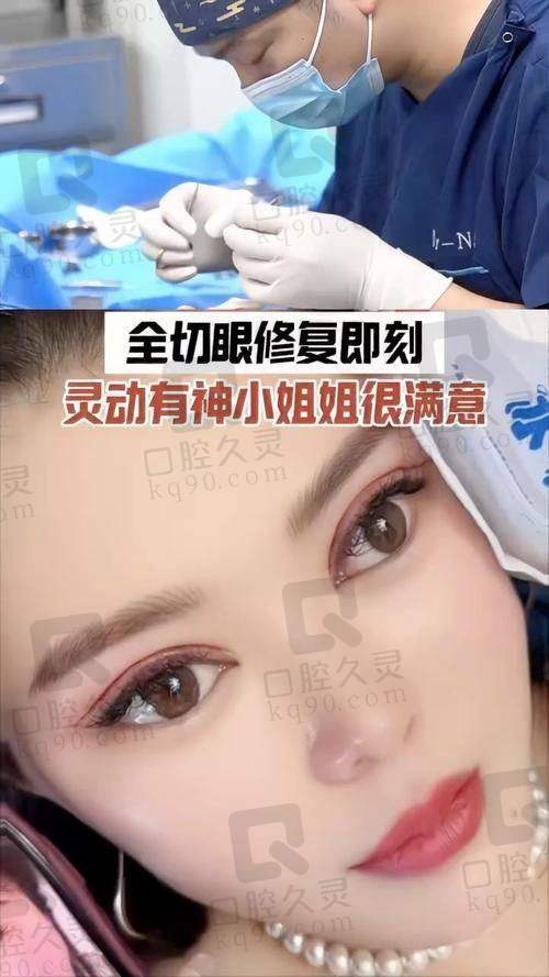 上海曾翾医生双眼皮修复水平高，从价格差异到手术优势，美眼攻略大公开！