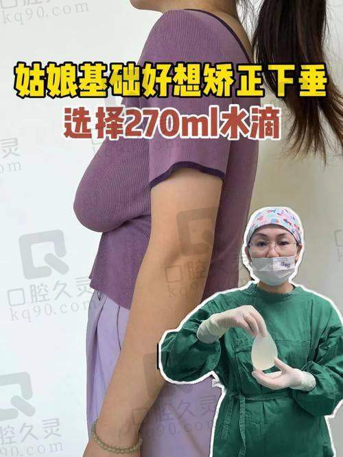 广州中家医家庭医生朱云乳房下垂矫正29750元起，手术后的舒适感、自然形态及快速修复