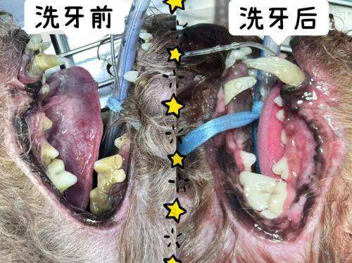 五、实现洗牙变白及牙齿美白的注意事项