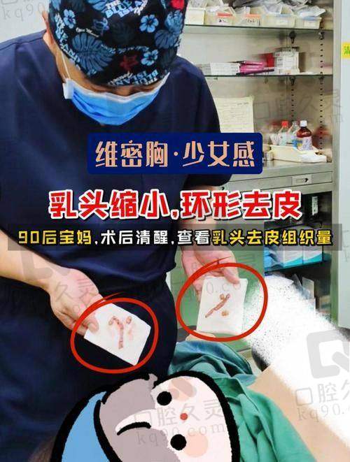 广州中家医家庭医生朱云乳头缩小6750元起的手术优势