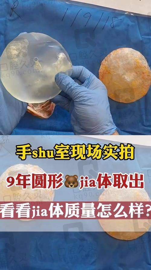真实实例分享