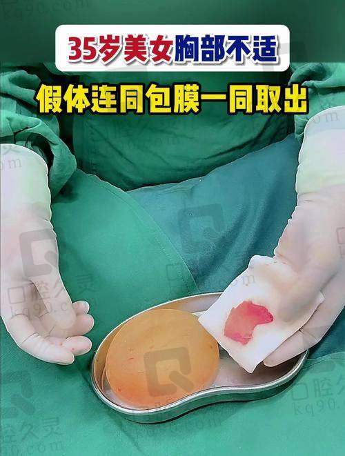 假体取手术类型及适应症介绍