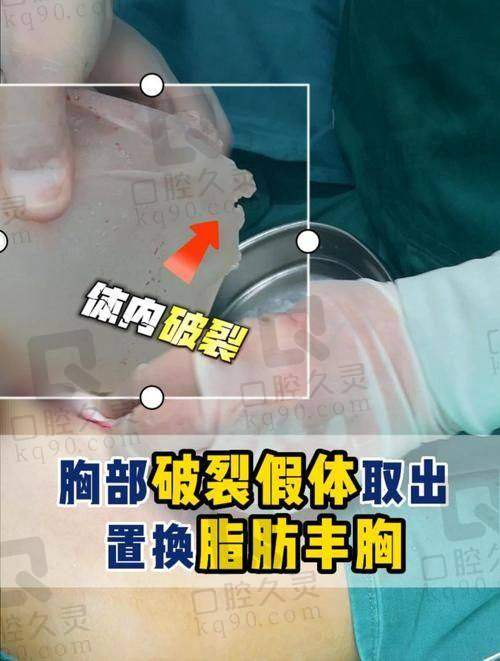 广州中家医朱云医生的技术优势