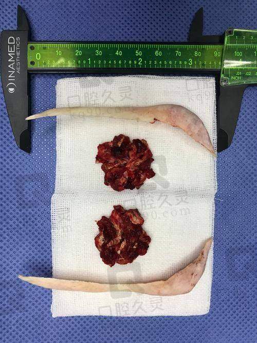 安可忍在重庆当代整形医院的地址电话与预约攻略：提前2个月排期，外地姐妹这样约