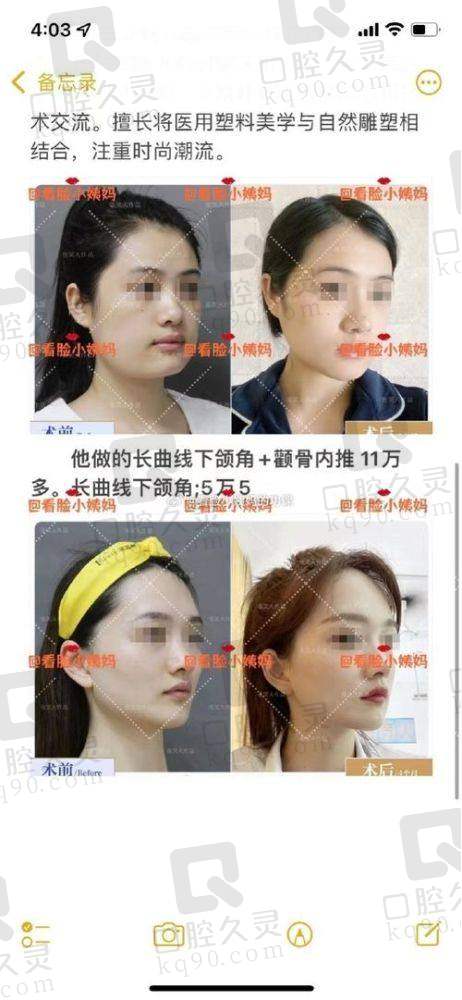 总结：安可忍在重庆当代整形医院——想做轮廓/缩胸的姐妹，这波可以冲！