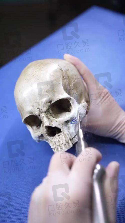 安可忍在重庆当代整形医院的磨骨技术实力解析：3D数字化+个性化方案，拒绝“模板脸”