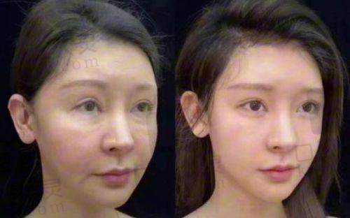 北京漾格医美顾客评价口碑到底怎样？