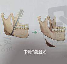广州中家医家庭整形医院隆胸与拉皮手术电话预约指南，400-***-9848助您实现美丽梦想