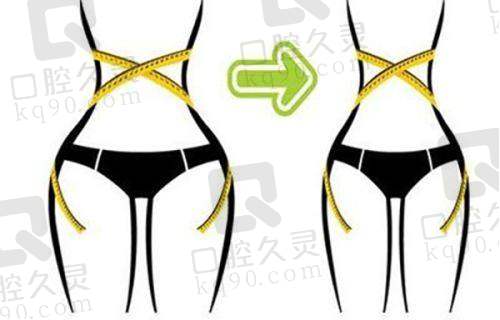 二、广州中家医家庭整形医院隆胸与拉皮手术技术优势