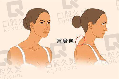 长春长庚耳鼻喉医院收费贵吗？收费项目透明吗？