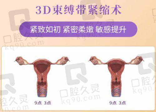 广州中家医家庭整形医院正规吗，值得信赖吗？正规私立医院技术实力强，隆胸手术效果自然真实！