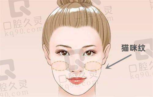 深圳米兰柏羽和深圳美莱哪家好？解读各大医院技术优势和价格信息，助您找到理想医美方案