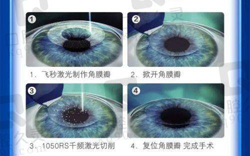 天津华厦眼科医院是三等甲吗？它的公益活动有哪些