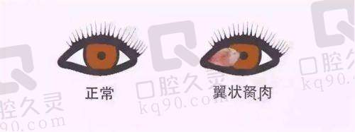 南通文慈眼科更厉害的三个医生之杨新生副院长实力如何？