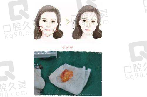 北京漾格医美的价格是否合理？