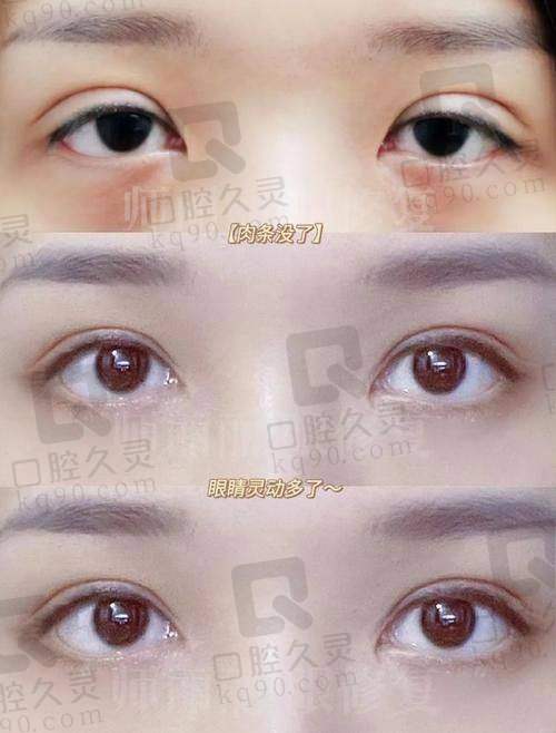 张海明的三维方法技术拆解，为什么几乎无修复失败？
