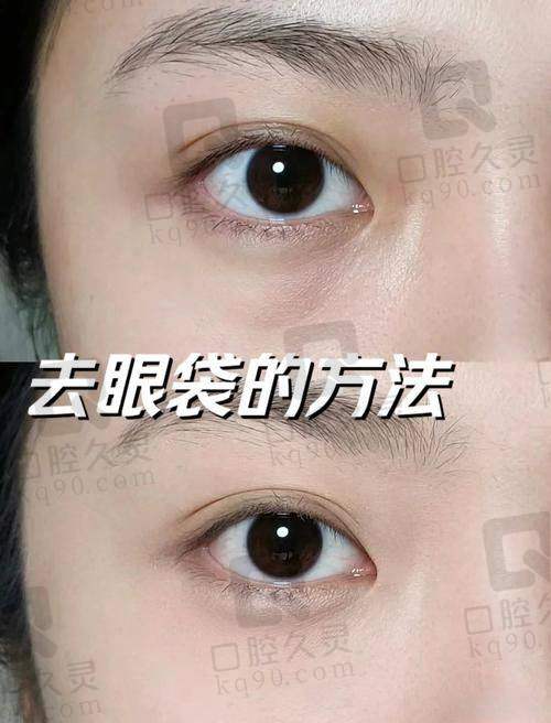 广州美诗沁医疗美容医院和奥拉克斯哪个好？美诗沁与奥拉克斯技术、口碑、价格对比分析