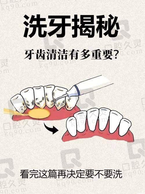 齐尔口腔的收费标准范围有哪些？