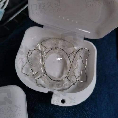 ❶ 牙套类型怎么挑？看完这张表秒懂！