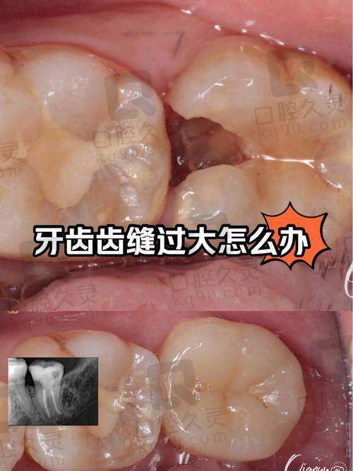 7. 湖州達(dá)美口腔醫(yī)院 - 快速診療的選擇