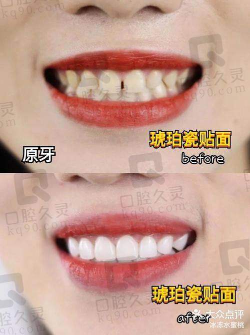 治疗过程：紧张又期待