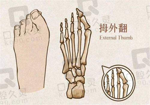 深圳鹏程整形医院的收费情况