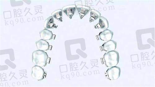佩戴牙套：适应与调整