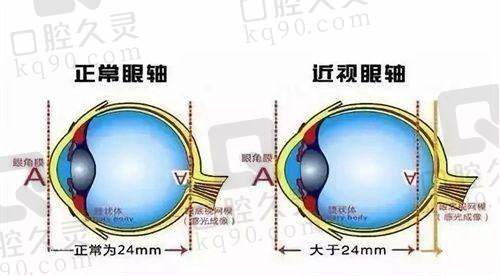 南宁佰视佳眼科做近视手术贵不贵？价格亲民有优势，手术质量还有保障！
