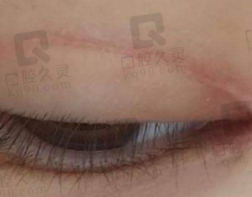 何珊珊医生的技术水平怎么样？