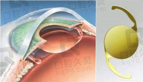 南宁佰视佳眼科是几级医院？二级甲等资质正规，近视手术靠谱价合理！