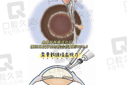 玉林爱尔眼科医院电话分享，价格透明、设备优，还有博士医生坐诊！ 