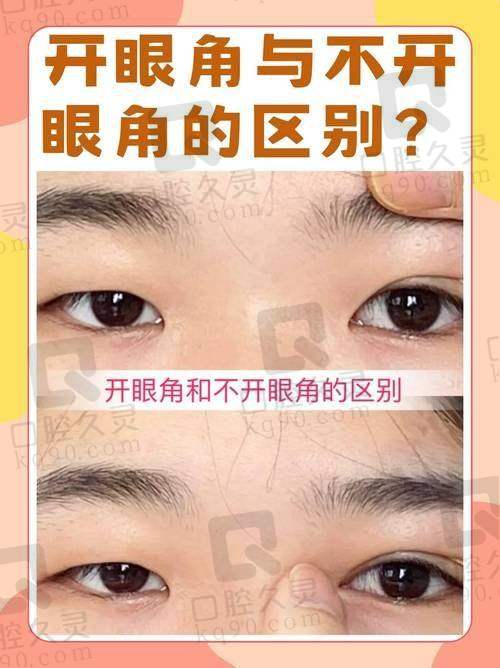 手术中的技术要点